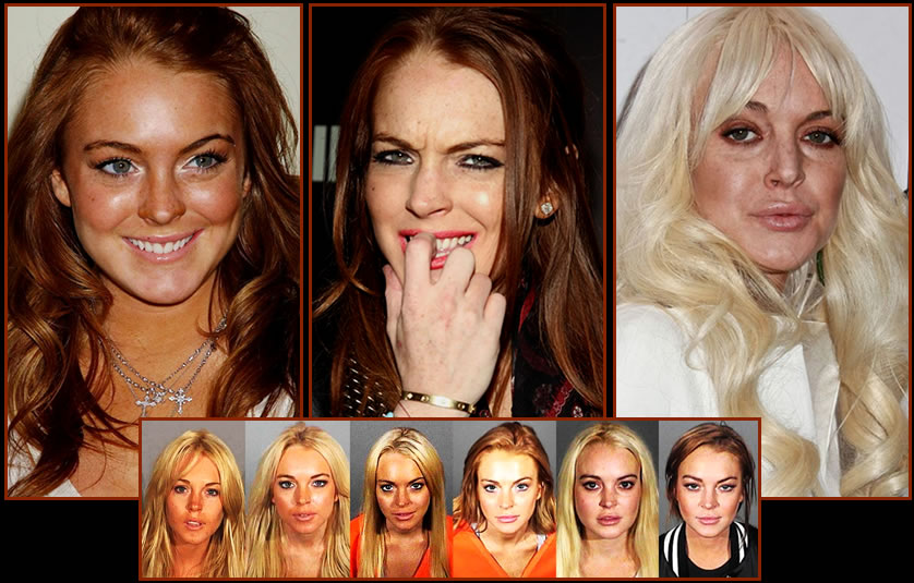 evolucion-lindsay