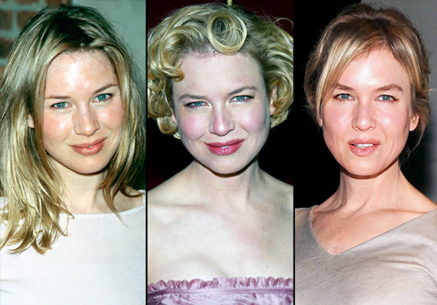 Renée Zellweger