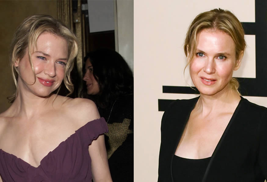 La transformación de Renée Zellweger