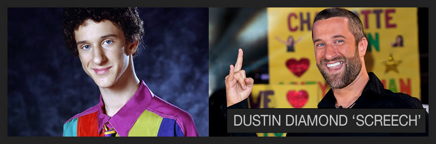 dustin-screech