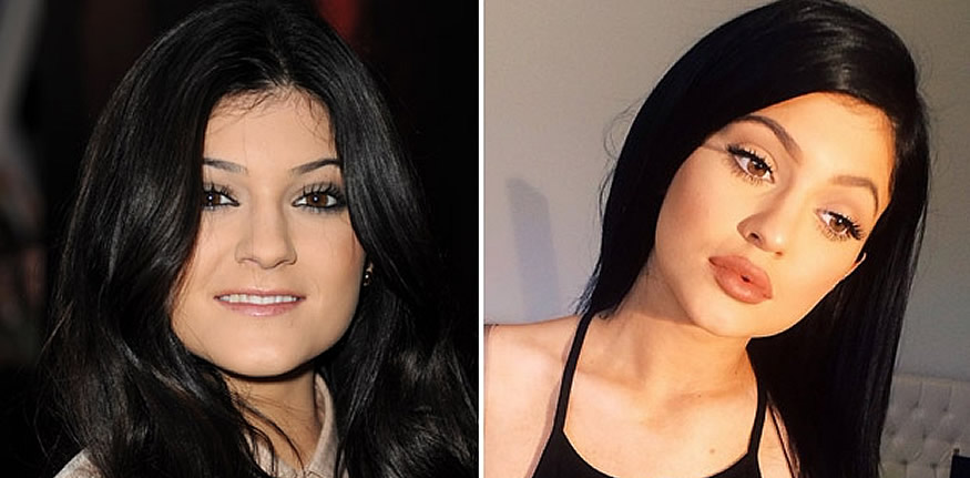 El reto de Kylie Jenner