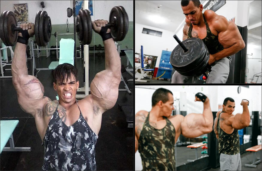 synthol