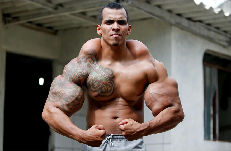 Músculos de synthol