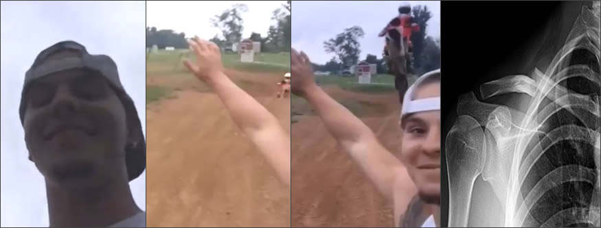 selfie en motocross